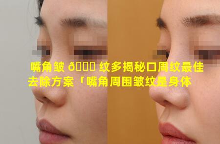 嘴角皱 💐 纹多揭秘口周纹最佳去除方案「嘴角周围皱纹是身体 🐵 哪里出现问题」